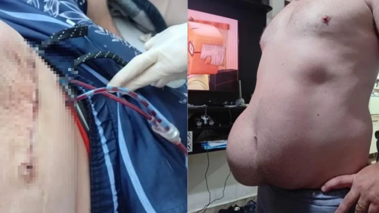 Motorista de app fica sem renda após complicações em cirurgia e pede ajuda para sustentar a família