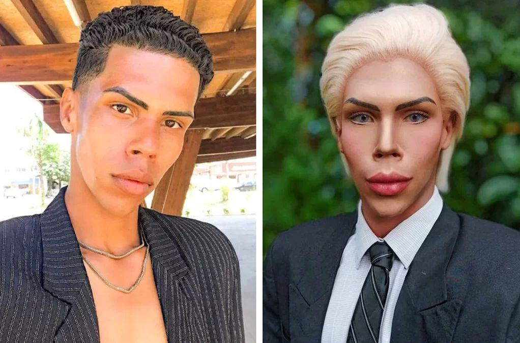 Ex-Ken Humano de Peruíbe relata crise, pede ajuda e diz temer viver nas ruas