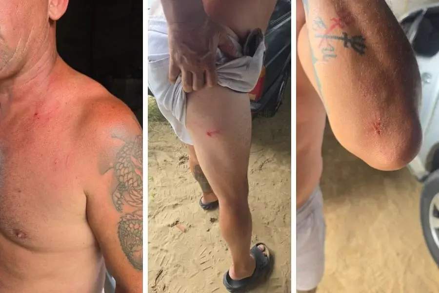 Homem que agrediu mulher com facão em Mongaguá diz que foi atropelado por ela